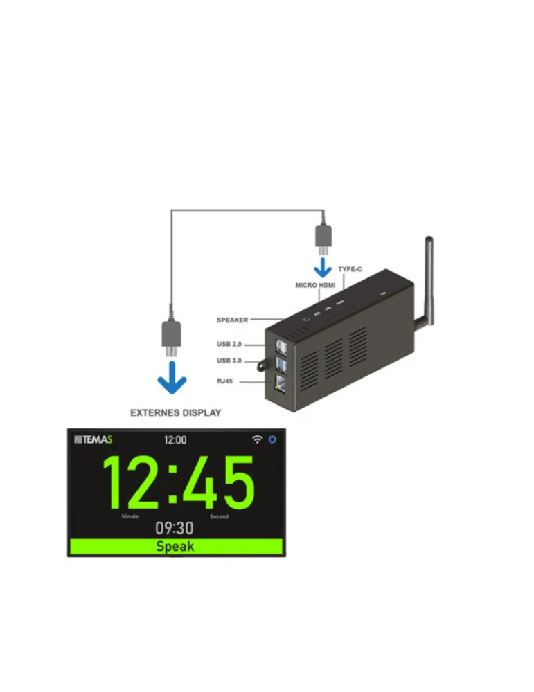 TEMAS ST300WSET Kit complet Timer  ST-300W livré dans une valise