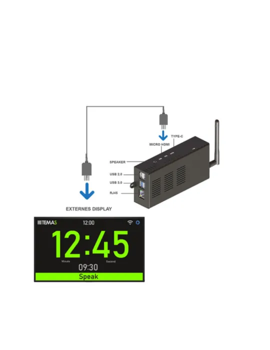 TEMAS ST300WSET Kit complet Timer  ST-300W livré dans une valise